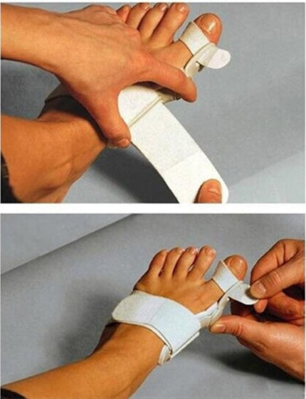 Hallux Valgus Bunion Corrector Splint with Toe Separator – Adjustable Day & Night Brace